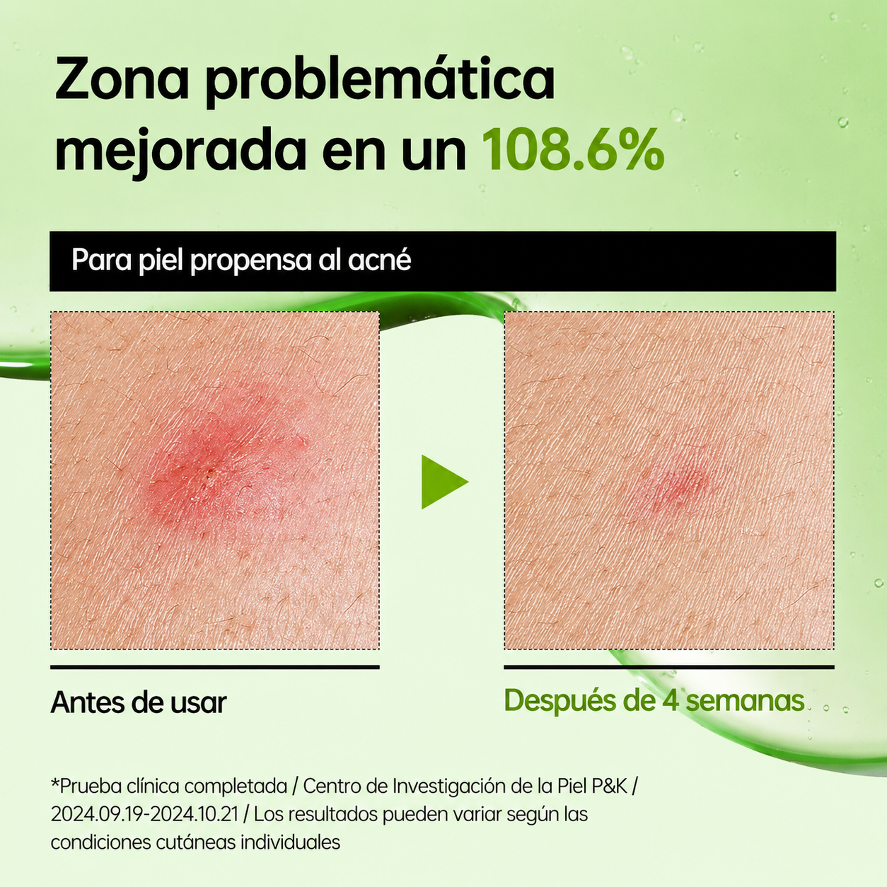 Sérum Calmante Ácido Azeláico 10% + Ácido Hialurónico Anua