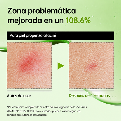 Sérum Calmante Ácido Azeláico 10% + Ácido Hialurónico Anua