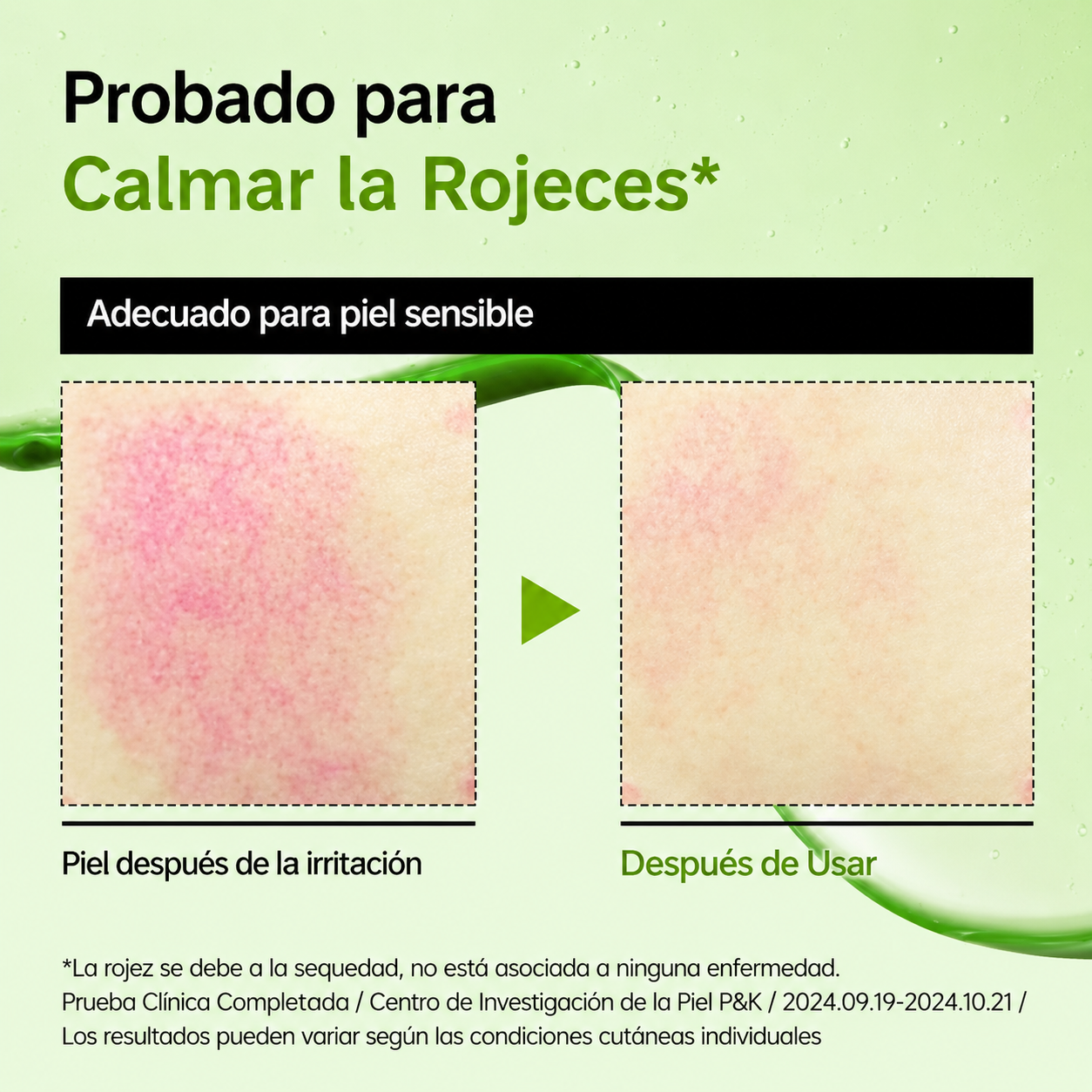 Sérum Calmante Ácido Azeláico 10% + Ácido Hialurónico Anua