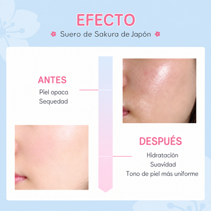Serum Aclarador Antimanchas Sakura con Flor de Cerezo LAIKOU