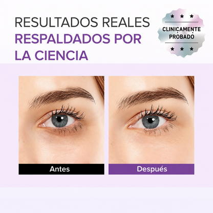 Contorno de Ojos Acido Tranexamico y Glutation Antiojeras Mary and May
