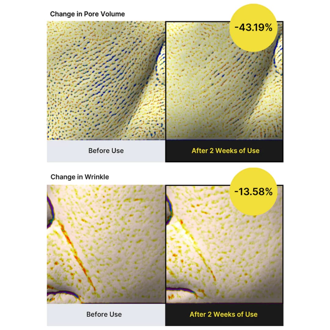 Serum Retinol Shot Tightening Celimax