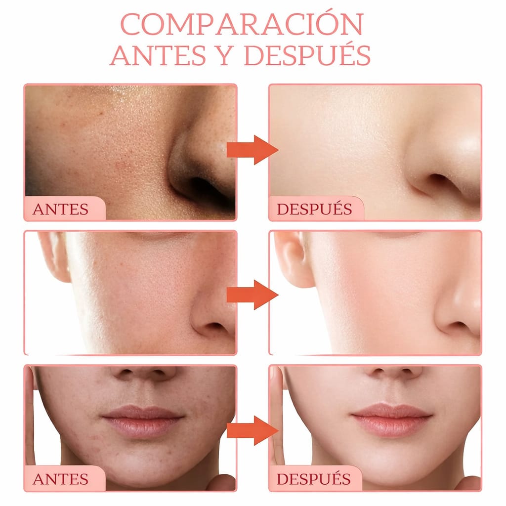 SRRTK Sérum Facial 5 en 1 Niacinamida Vitamina C y Colágeno