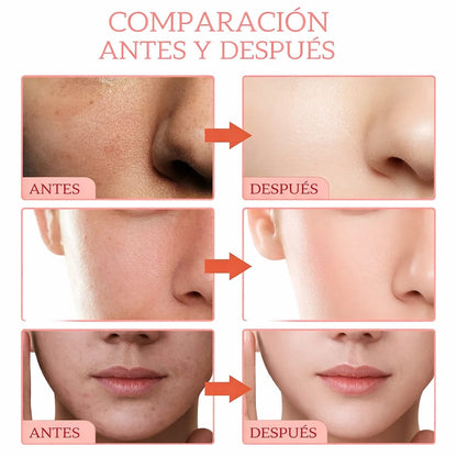 SRRTK Sérum Facial 5 en 1 Niacinamida Vitamina C y Colágeno