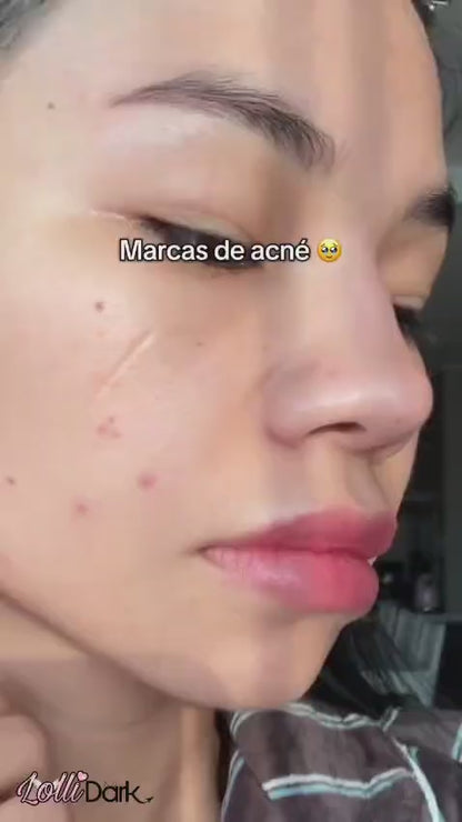 SKIN1004 Madagascar Centella Cream | Crema Calmante Coreana